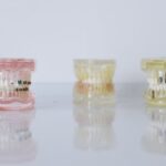 Restore Your Confidence with Custom Dentures in Auckland, NZ