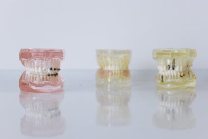 Restore Your Confidence with Custom Dentures in Auckland, NZ